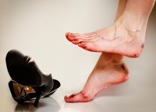 Le développement de mycose des ongles des pieds peut être causé par des chaussures serrées
